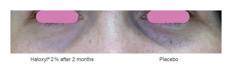  decreases dark circles with Haloxyl™  and and reduces bags and puffiness under the eyes with Eyeliss™